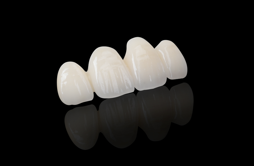 Porcelain Layered Zirconia